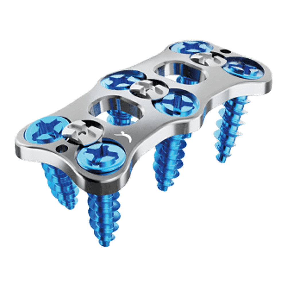 Imagen destacada de Placa Cervical Anterior PROCTOPUS™