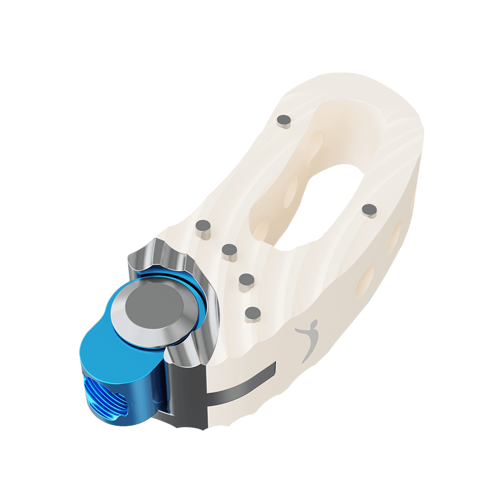 Imagen destacada de Caja Intersomática Lumbar TLIF PEEK Cage