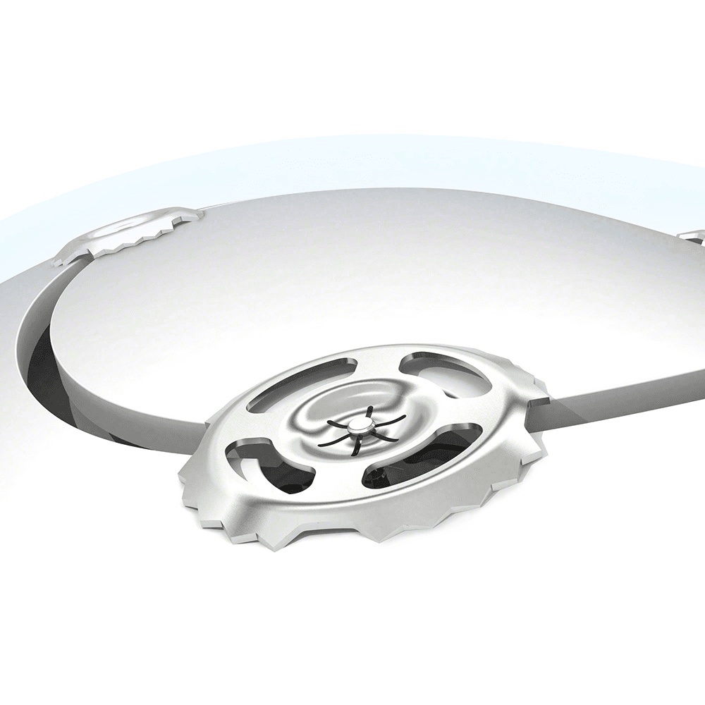 Imagen destacada de Fijación Craneal Craniofix 2