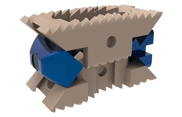 Imagen destacada de Caja Intersomática Lumbar Expandible KAGE™